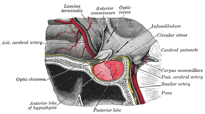 Section through the pituitary gland in its bony seat, hanging from the infundibulum behind the optic chiasm, Gray's Anatomy, 20th edition, 1918, figure 1180