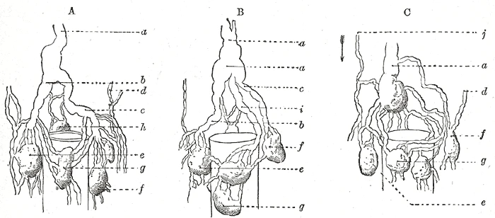 Three ways the thoracic duct begins, each with a cisterna chyli at its foot fed by trunks from the nodes beside the aorta, schematic, Gray's Anatomy, 1918, figure 600