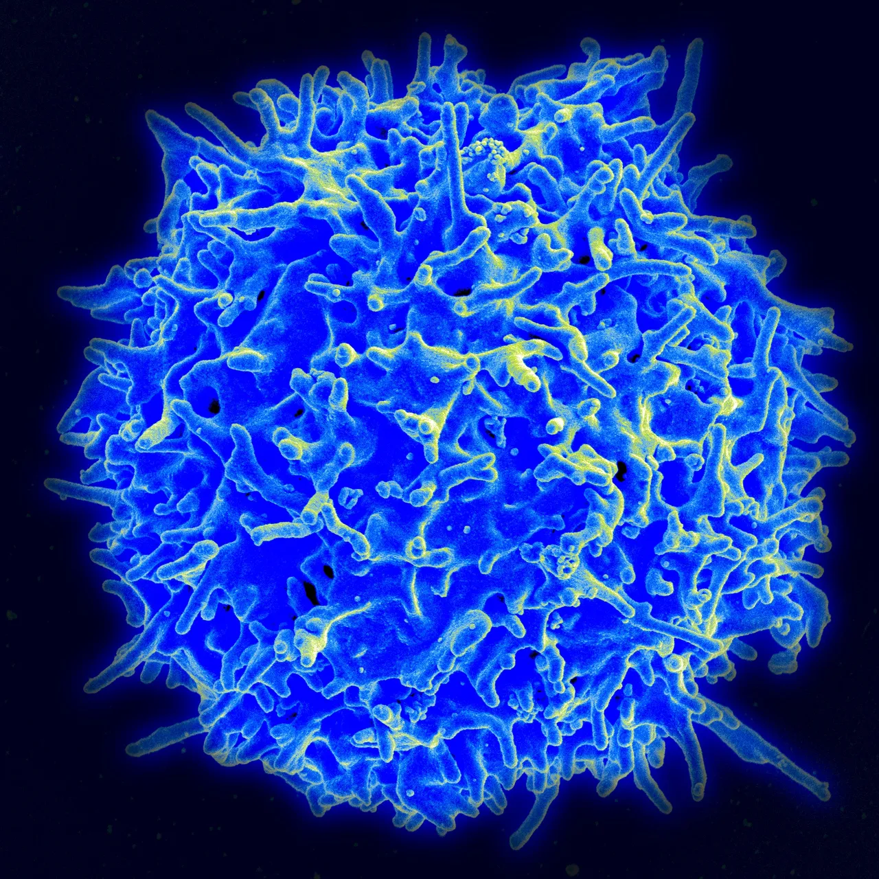 A human T cell from a healthy donor, scanning electron micrograph in false colour, NIAID