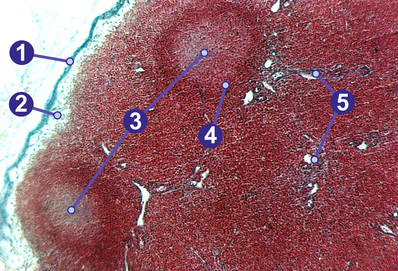 A pig's lymph node under the microscope: 1 capsule, 2 subcapsular sinus, 3 germinal centres, 4 lymphoid nodule, 5 trabeculae