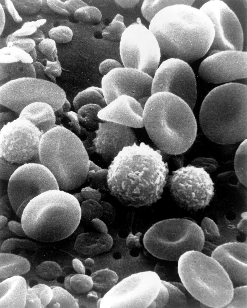 Red cells, white cells and platelets in circulating human blood, scanning electron micrograph