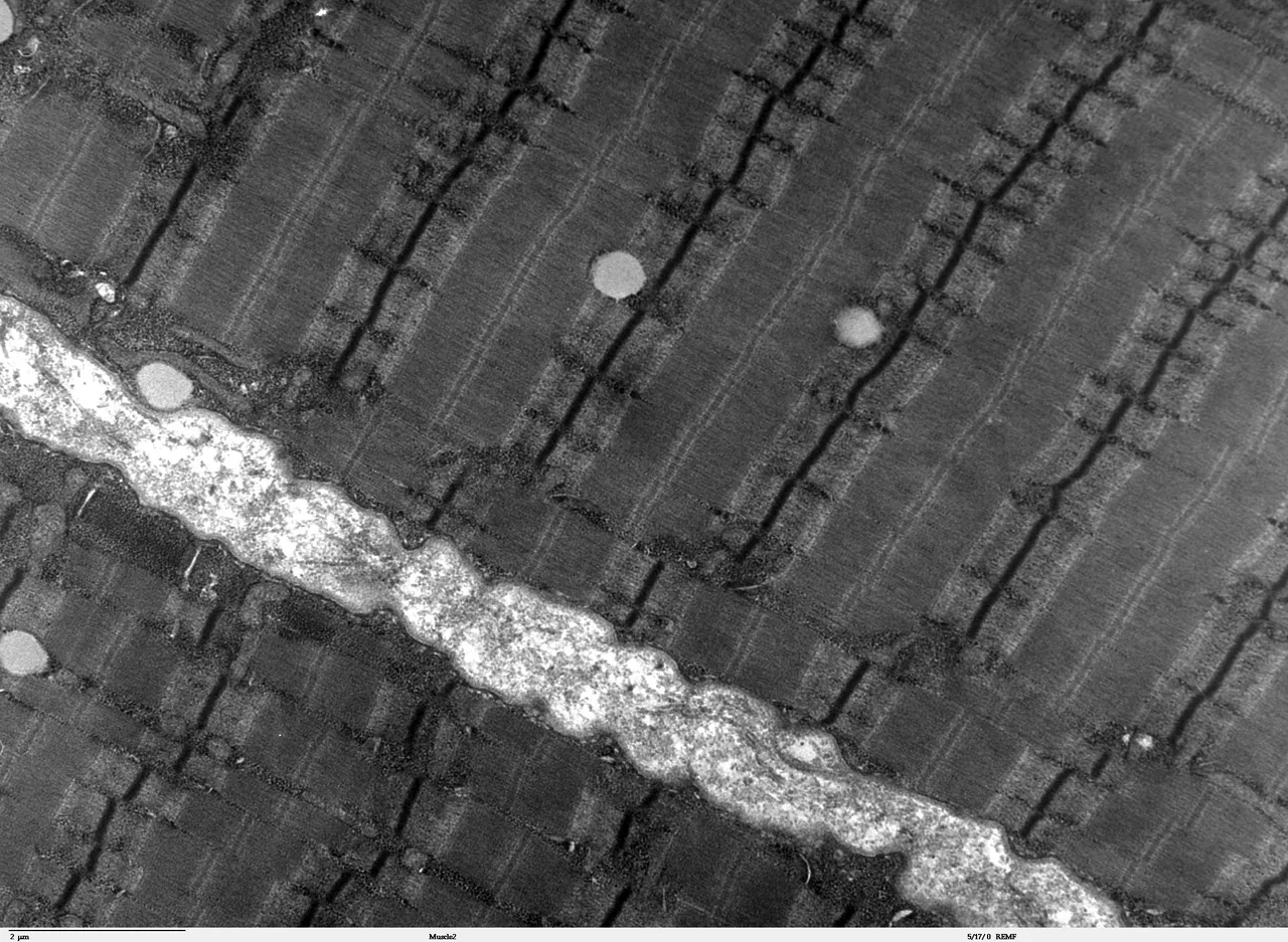 Elektron mikroskobunda insan iskelet kası, miyofibrilleri yinelenen sarkomerlerle bantlı, Dartmouth Electron Microscope Facility