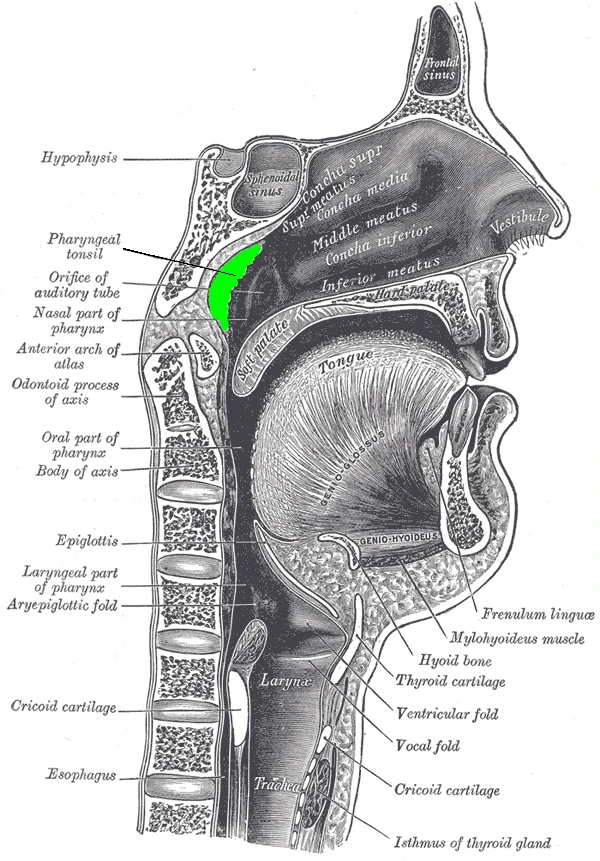 A midline cut through the nose, mouth and throat, with the pharyngeal tonsil, the adenoid, coloured green, Gray's Anatomy, 1918, figure 994