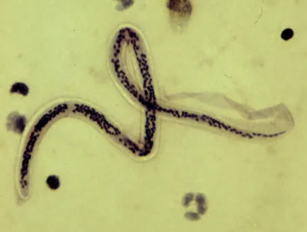A larva of Wuchereria bancrofti, a microfilaria, in a blood smear stained with haematoxylin, CDC DPDx