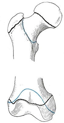 Genç bir yetişkinin uyluk kemiğinin uçları, büyüme plaklarının kapandığı çizgiler siyah, Gray’s Anatomy, 1918, şekil 253