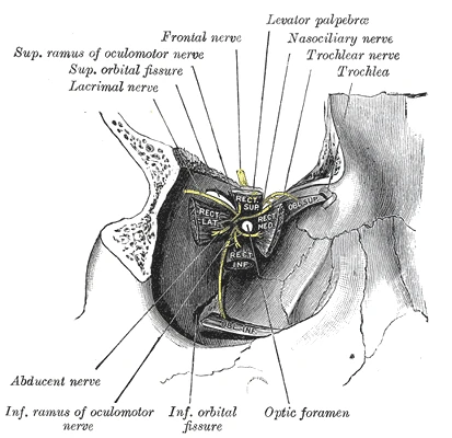 The origins of the eye muscles at the back of the right orbit, with the oculomotor, trochlear and abducent nerves entering, Gray's Anatomy, 20th edition, 1918, figure 787