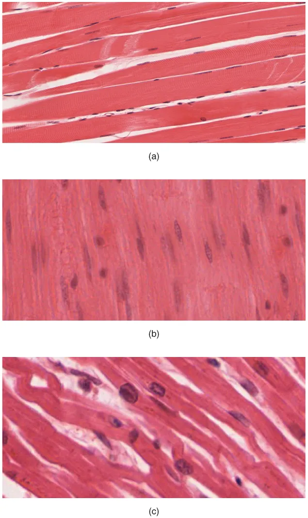 Skeletal, smooth and cardiac muscle under the light microscope, from top to bottom, OpenStax Anatomy and Physiology