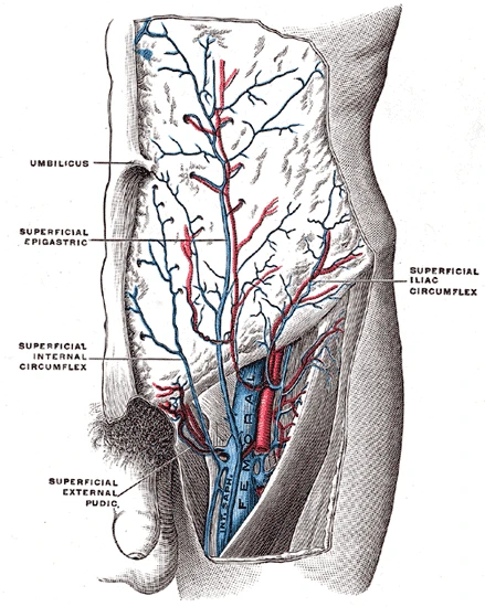 The great (internal) saphenous vein joining the femoral vein in the groin, with the small superficial veins of the lower abdomen, Gray's Anatomy, 1918, figure 584